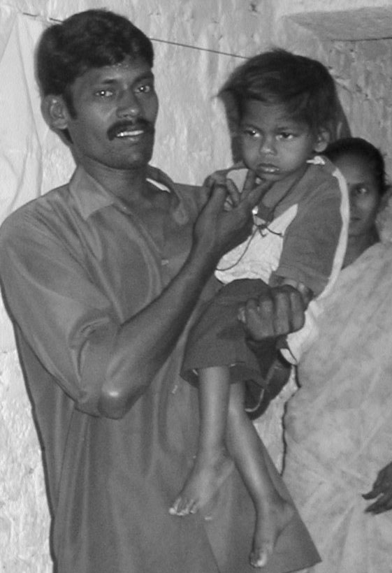 Con la ayuda del programa de Rehabilitación Basada en la Comunidad del Centro de Mana para familias en los barrios bajos de Hyderabad, este padre aprende a ayudar en el desarrollo de su hijo con discapacidad múltiple.