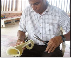 Un útil carpintero local cortó tiras de espuma plástica, las pegó dentro de las divisiones como relleno, y recortó cuidadosamente los bordes. Las férulas terminadas parecían bastante profesionales, pero fueron hechas en el acto, con la ayuda del niño, su madre y trabajadores voluntarios, casi sin costo.