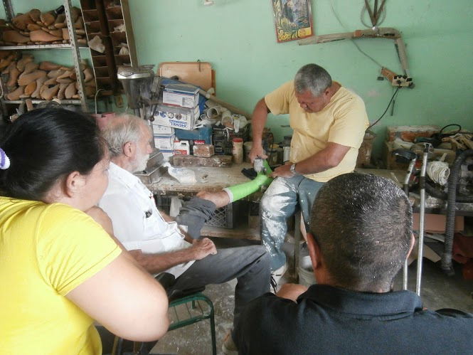 Al mismo tiempo que PROJIMO hizo nuevas ortesis para Tomás, también hicieron una para mí. Aquí Inez quita el yeso en mi pie recién operado, para tomar un yeso para el soporte.