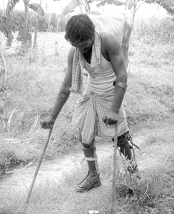 Alok, who is paraplegic and walks with braces, leads a cow.