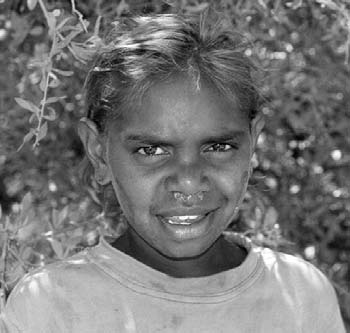 Aboriginal children have frequent colds and runny noses, which leads to chronic ear infections and very high rates of moderate to severe deafness.
