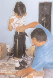 Armando, in Coyotitan, measures a boy for twister cables to help straighten his legs.