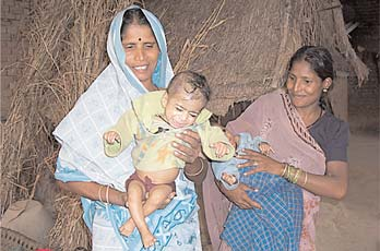 A mother holds her undernourished disabled girl child. In India to be poor, female, and disabled is to have 3 strikes against you.