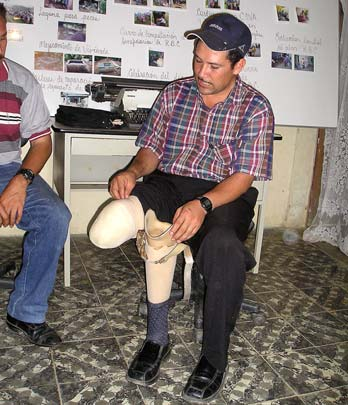 Santos Barrientos lost his leg to a landmine 8 years after the end of the Contra war.