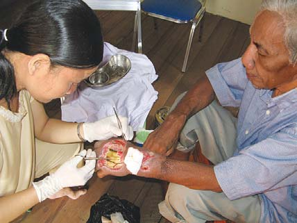 The nurse, Klara, did a wonderful job in cleaning and caring for Pak Tahir’s diabetic ulcer.