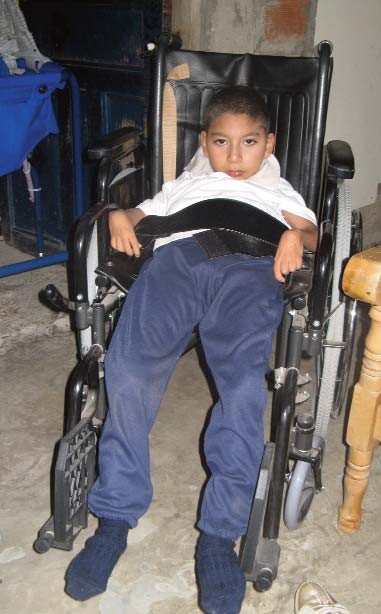 Oversize, adult wheelchairs with children slipping out of them—as this boy is—are very common in Colombia and in many countries I’ve visited.