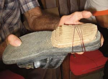 Simply adding cardboard under Orlieda’s shoe created a lift to even out the length of her legs. It’s easy to adjust the lift by adding or removing cardboard layers.