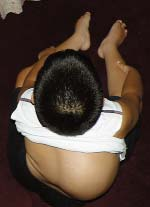 Padded cushions designed to accomodate his spinal deformity push Jorge too far forward to properly use the wheelchair.